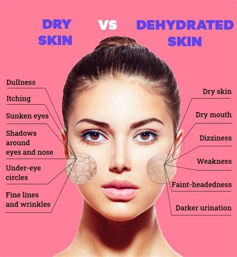 Treat Dehydrated Skin To Reveal The Flawless You Be Beautiful India