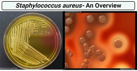 Staphylococcus Aureus An Overview Microbe Notes 2023