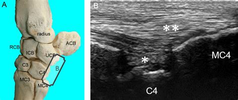 Ultrasonography Of The Carpus Veterian Key