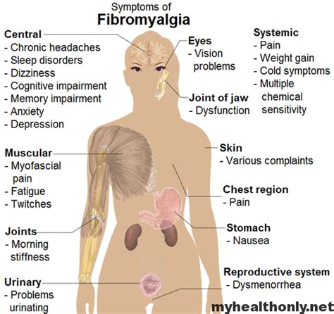 Fibromyalgia Trigger Points Causes And Symptoms My Health Only