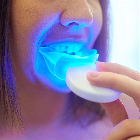 The Best Teeth Whitening Kit For A Brighter Whiter Smile