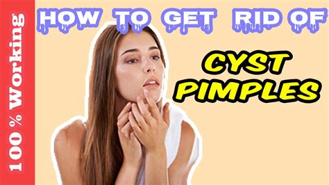 How To Get Rid Of Cyst Pimples Overnight Fast Home Remedies
