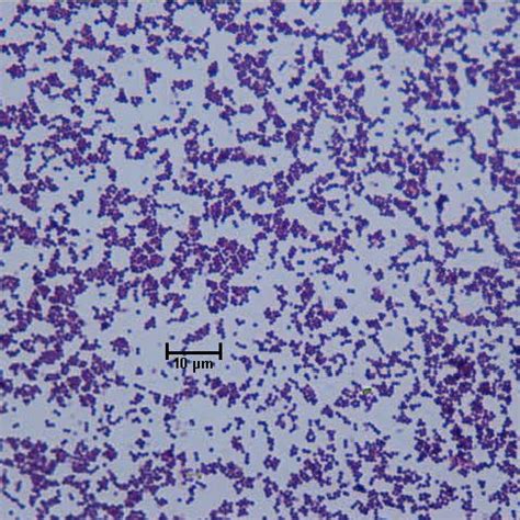 The golden appearance of colonies of some strains is the etymological root of the. Bacteria Under Microscope 1000x - Micropedia