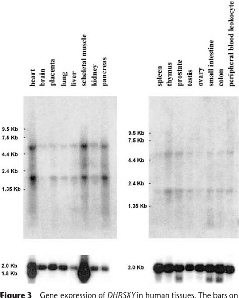 Figure 1 From Differential Divergence Of Three Human Pseudoautosomal Genes And Their Mouse