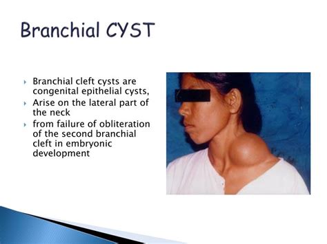 Ppt Neck Swelling Differential Diagnosis Powerpoint Presentation Id