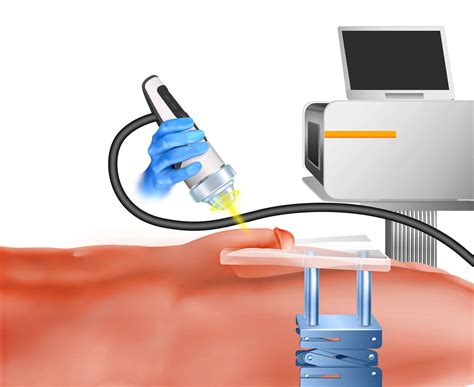 Peyronie S Shockwave Therapy Best Private PD Clinic