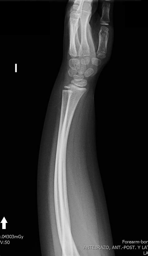 Simple Science: How to Make a Volcano with Kids