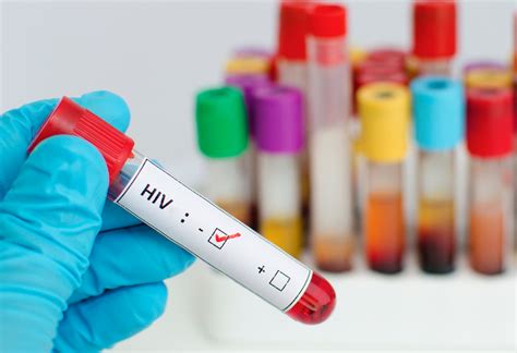 Ujian boleh dilakukan di hospital, makmal swasta atau pusat kesihatan yang mempunyai kemudahan ujian hiv. Ujian HIV Pra-Perkahwinan