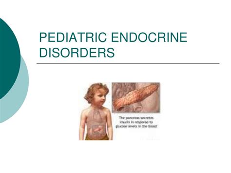 Ppt Pediatric Endocrine Disorders Powerpoint Presentation Free