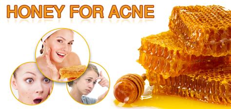 honey for acne best alternate remedy to cure scars