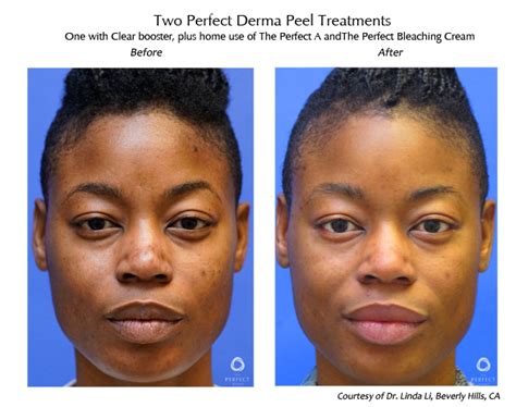 The Perfect Derma Star Spa Uptown