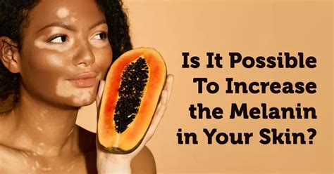 Is It Possible To Increase The Melanin In Your Skin Myvitiligoteam