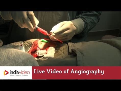 Average prices of more than 40 products and services in malaysia. Live Video of Angiography at Lisie Hospital | How ...