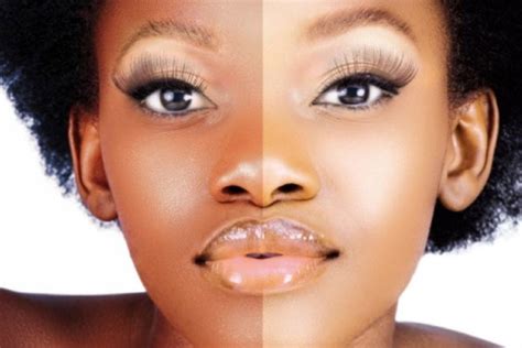 What It Means For Rwanda To Have Banned Skin Bleaching Creams Dazed