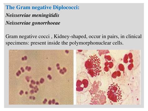 Gram Positive Cocci Examples Gram Positive Bacteria Classifications
