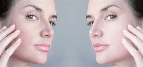 8 Signs You Probably Have Sensitive Skin Viviane Woodard Skincare