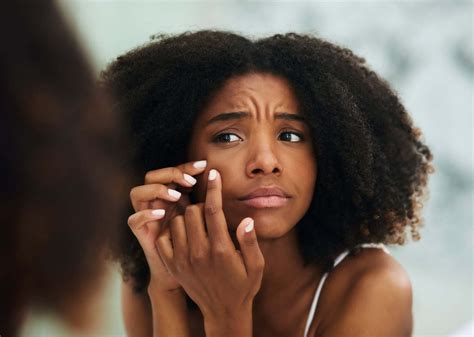 Acne Awareness Month What Type Of Treatment Does Your Skin Need