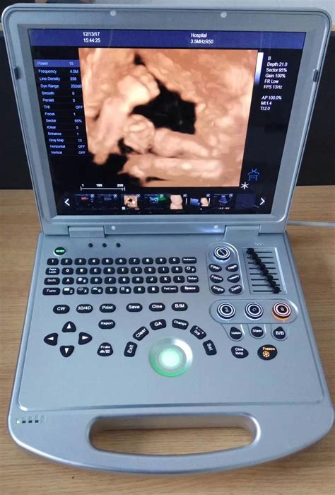 Advantages Of 3d Ultrasound Used In Obstetric Blog Henan Forever