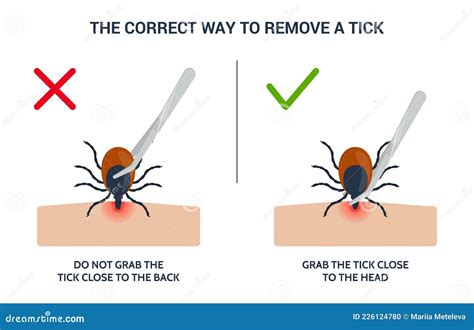 The Correct Way To Remove A Tick Insect Correctly Infographic Tips For