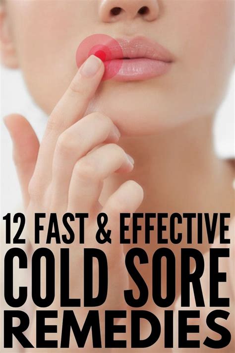 Pin By Ruttger5f4k3 On Beauty In 2020 Cold Sores Remedies Natural