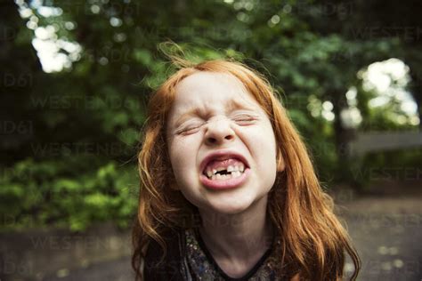 Close Up Of Girl Clenching Teeth At Park Stock Photo