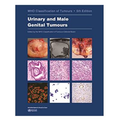 Who S Classification Of Tumours Female Genital Tumours Th Edition