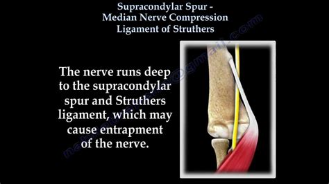 Median Nerve Compression Supracondylar Process Everything You Need