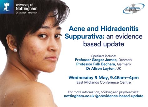 Acne And Hidradenitis Suppurativa An Evidence Based Update Campus News