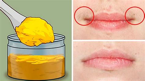 how to get rid of facial hair naturally youtube
