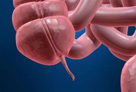 Appendices allow you to include detailed information in your paper that would be distracting in the main body of the paper. Ode to My Ruptured Appendix | You&Me Magazine