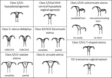Classification Of M Llerian Duct Anomalies According To The Afs And
