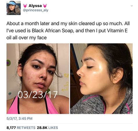 Amandaaa Face Skin Care Makeup Skin Care Skin Tips Skin Care