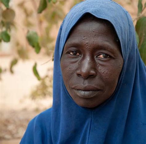 Saving Lives Among Malis Displaced Crs