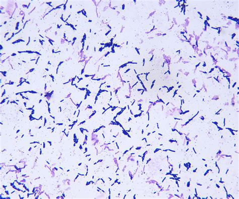 Clostridium Septicum Gram Stain Gram Stain Of Pure Clostri Flickr