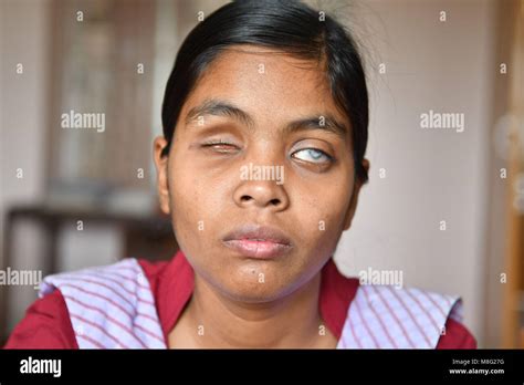 indian blind people