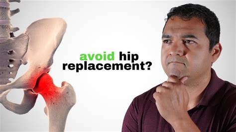 Can You Actually Cure Hip Arthritis And Avoid Replacement Surgery