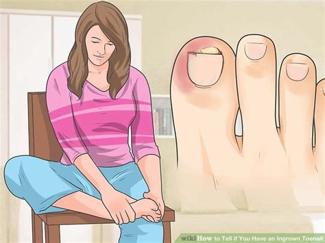 Here's how to prevent and care for your toes. How to Tell if You Have an Ingrown Toenail: 11 Steps