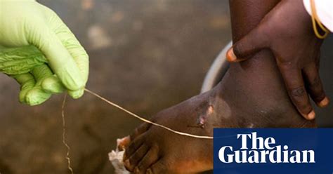Somewhat Less Neglected Tropical Diseases Society The Guardian
