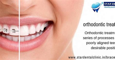 Orthodontics Treatment In Pimple Saudagar Pune Album On Imgur