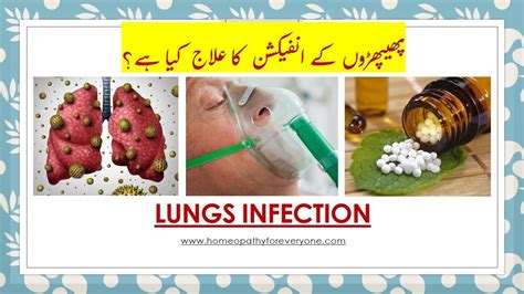 Lungs Infection Best Homeopathy Treatment फेफड़ों का संक्रमण