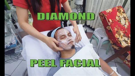 Diamond Peel Facial Procedure And Experience Sa Butuan Youtube