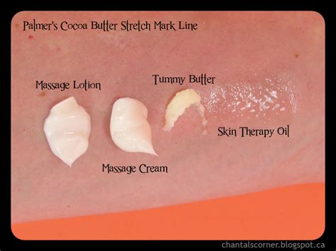 Widely recommended for stretch marks during and after pregnancy or weight fluctuation. Palmer's Cocoa Butter Stretch Mark Line - Review - Chantal ...