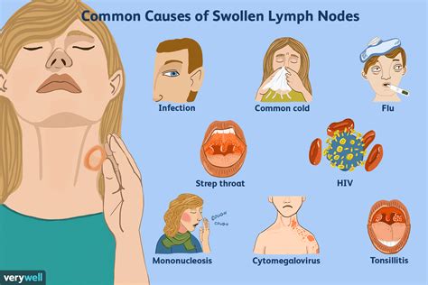 How To Tell A Lump From A Lymph Node Best Doctor Beverly Hills