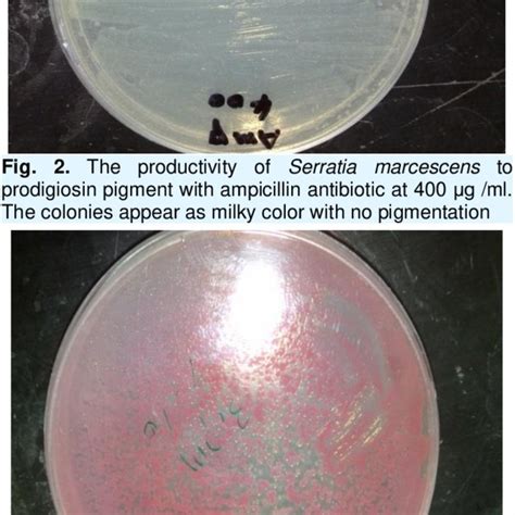 The Productivity Of Serratia Marcescens To Prodigiosin Pigment With
