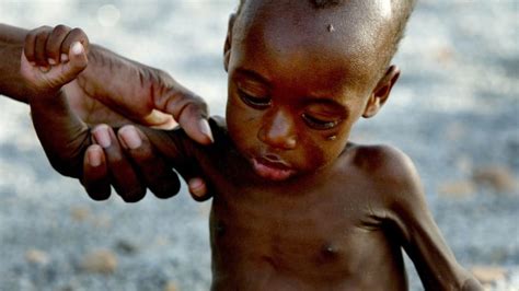 Famine Has Killed Thousands In West Africa Un Says Cbc News