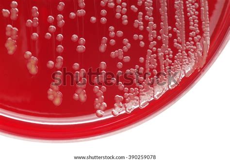 Staphylococcus Aureus Bacterial Colonies On Blood Stock Photo