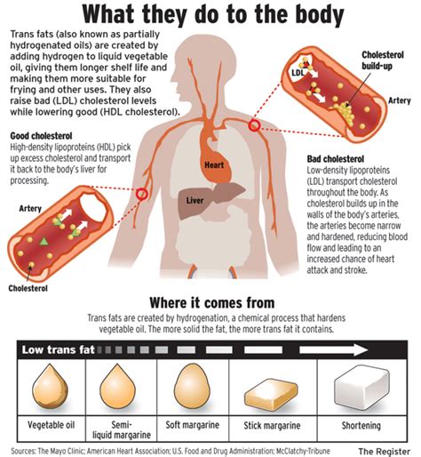 Who For Eliminating Trans Fats By 2023 Ifba Join Hands