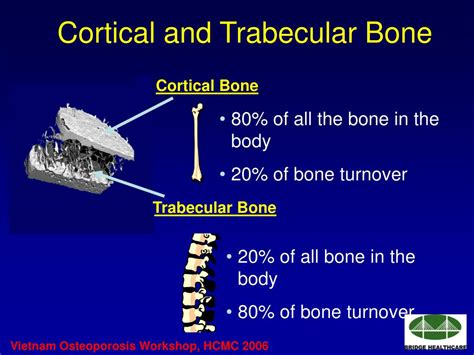 Trabecular Vs Cortical Bone Osteoporosis Slidesharetrick