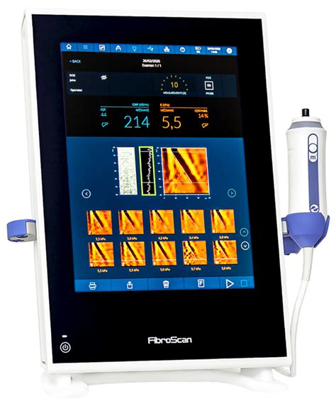 Fibroscan® Painless Accurate Noninvasive Way To Assess Liver Health