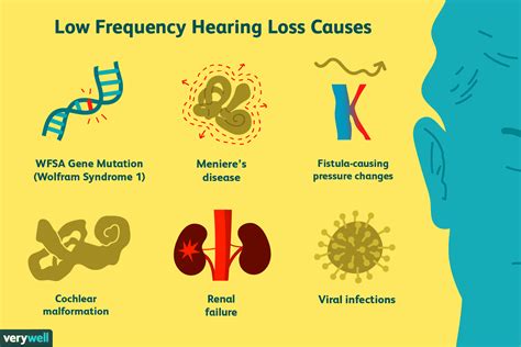 Low Frequency Hearing Loss Causes Diagnosis And More